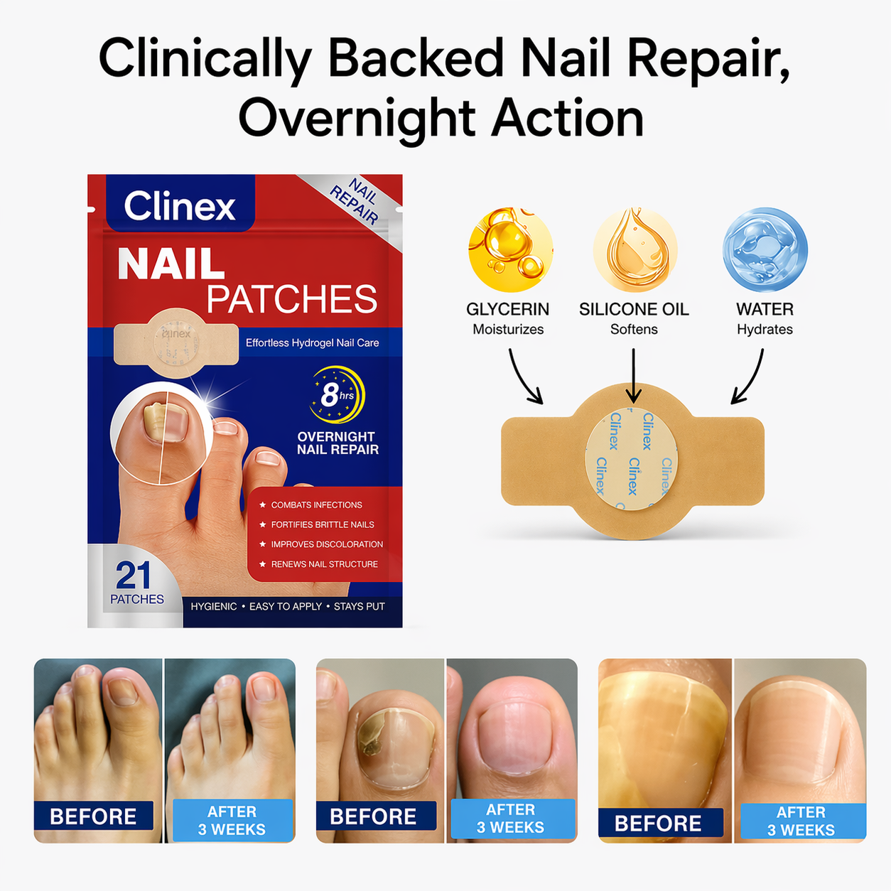 Clinex Fungal Nail Patches